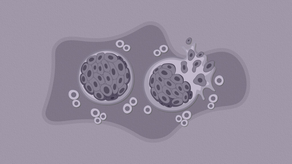 La detección temprana del cáncer: clave para reducir la mortalidad