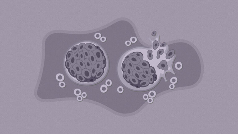 La detección temprana del cáncer: clave para reducir la mortalidad