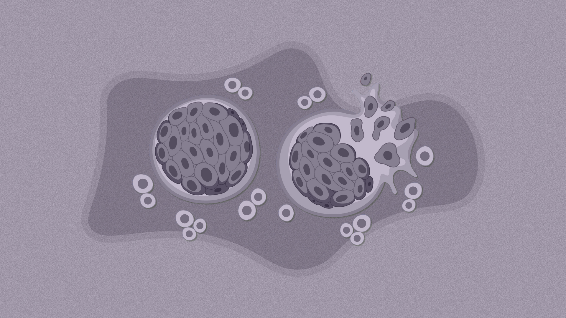 La detección temprana del cáncer: clave para reducir la mortalidad